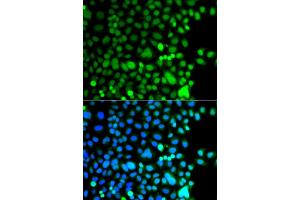 Immunofluorescence analysis of A549 cells using AEBP2 antibody (ABIN5975286).