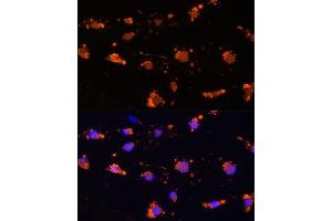 Immunofluorescence analysis of L929 cells using CD172a/SIRPα Rabbit pAb (ABIN6130058, ABIN6147780, ABIN6147781 and ABIN6224854) at dilution of 1:100 (40x lens). (SIRPA Antikörper  (AA 395-504))