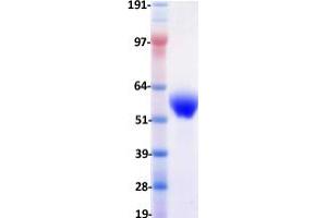 Western Blotting (WB) image for Receptor Tyrosine Kinase-Like Orphan Receptor 1 (ROR1) (Transcript Variant 1) protein (DYKDDDDK-His Tag) (ABIN2731084)