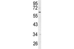 Western blot analysis of RIPK3 antibody and Ramos lysate. (RIPK3 Antikörper  (AA 1-30))