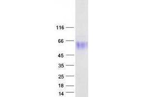 Validation with Western Blot