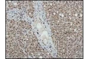 Immunohistochemistry (IHC) image for anti-Nitric Oxide Synthase 2, Inducible (NOS2) antibody (ABIN870300) (NOS2 Antikörper)