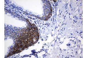 Image no. 8 for anti-NADH Dehydrogenase (Ubiquinone) 1 beta Subcomplex, 10, 22kDa (NDUFB10) antibody (ABIN1499672) (NDUFB10 Antikörper)