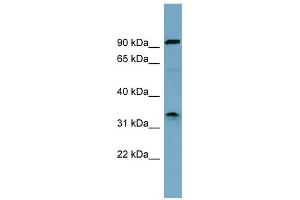 WB Suggested Anti-SDS Antibody Titration:  0. (serine Dehydratase Antikörper  (Middle Region))