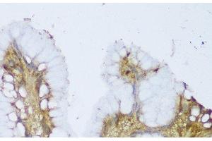 Immunohistochemistry of paraffin-embedded Human stomach using GCN1L1 Polyclonal Antibody at dilution of 1:150 (40x lens). (GCN1L1 Antikörper)