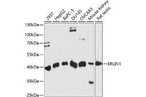 Western blot analysis of extracts of various cell lines, using ERLIN1 antibody (ABIN7267005) at 1:1000 dilution. (ERLIN1 Antikörper  (AA 259-348))