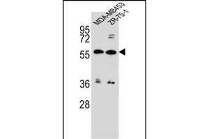 ABCG4 Antibody (N-term) (ABIN656651 and ABIN2845892) western blot analysis in MDA-M,ZR-75-1 cell line lysates (35 μg/lane).