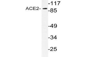 Western blot (WB) analyzes of ACE2 antibody in extracts from HeLa cells. (ACE2 Antikörper)