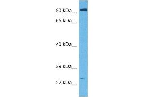 Western Blotting (WB) image for anti-E2F Transcription Factor 7 (E2F7) (N-Term) antibody (ABIN2780153)