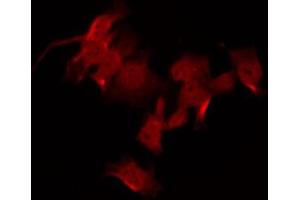 ABIN6267609 staining NIH-3T3 by IF/ICC. (FAK Antikörper  (pTyr925))