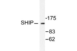 Image no. 1 for anti-Inositol Polyphosphate-5-Phosphatase, 145kDa (INPP5D) antibody (ABIN271812) (INPP5D Antikörper)