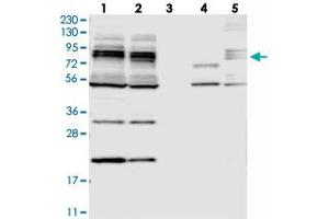 Western blot analysis of Lane 1: RT-4, Lane 2: U-251 MG, Lane 3: Human Plasma, Lane 4: Liver, Lane 5: Tonsil with MAK10 polyclonal antibody . (MAK10/NAA35 Antikörper)