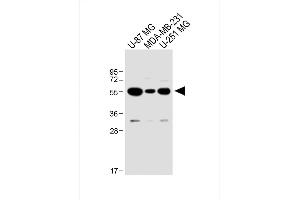 All lanes : Anti-USP17L24 Antibody (C-term) at 1:1000 dilution Lane 1: U-87 MG whole cell lysate Lane 2: MDA-MB-231 whole cell lysate Lane 3: U-251 MG whole cell lysate Lysates/proteins at 20 μg per lane. (USP17L24 Antikörper  (C-Term))