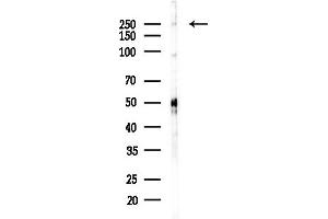 anti-Phospholipase C, epsilon 1 (PLCE1) antibody