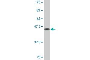 Western Blot detection against Immunogen (46. (Dual Specificity Phosphatase 3 (DUSP3) (AA 1-185) Antikörper)