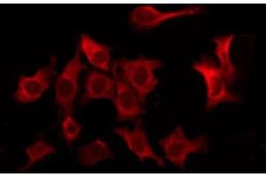 Immunofluorescence (fixed cells) (IF/ICC) image for anti-Fc Fragment of IgG, Low Affinity IIb, Receptor (CD32) (FCGR2B) (C-Term) antibody (ABIN6261702)