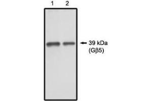 Image no. 1 for anti-Guanine Nucleotide Binding Protein (G Protein), beta 5 (GNB5) antibody (ABIN265062)