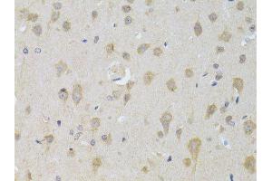 Immunohistochemistry (Paraffin-embedded Sections) (IHC (p)) image for anti-Autophagy Related 13 (ATG13) (AA 281-480) antibody (ABIN3021088)