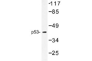 Image no. 1 for anti-Tumor Protein P53 (TP53) antibody (ABIN272156) (p53 Antikörper)