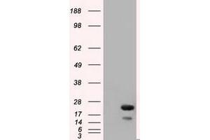Western Blotting (WB) image for anti-RAB17, Member RAS Oncogene Family (RAB17) antibody (ABIN1500538)