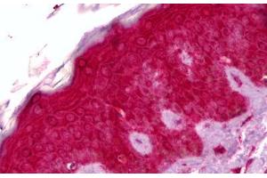 Anti-GPNMB antibody IHC staining of human skin. (Osteoactivin Antikörper  (AA 1-572))