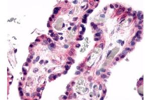 Immunohistochemical staining of Placenta (Villi) using anti- GPR78 antibody ABIN122184 (GPR78 Antikörper)