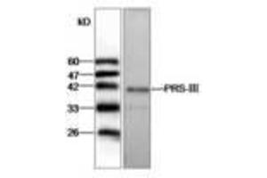 Image no. 1 for anti-phosphoribosyl Pyrophosphate Synthetase 1-Like 1 (PRPS1L1) antibody (ABIN791432) (PRPS1L1 Antikörper)