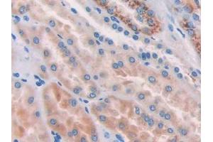 DAB staining on IHC-P; Samples: Human Kidney Tissue (Nicastrin Antikörper  (AA 420-655))