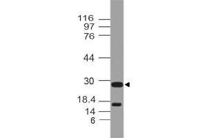 Image no. 1 for anti-Cytokine Receptor-Like Factor 2 (CRLF2) (AA 102-310) antibody (ABIN5027603) (CRLF2 Antikörper  (AA 102-310))