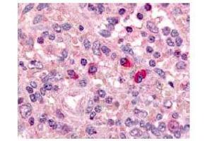 Immunohistochemical staining of ARTEMIS in Formalin fixed and Paraffin embeddes human spleen using antibody ABIN117935. (DCLRE1C Antikörper  (AA 482-495))