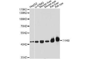 Western blot analysis of extracts of various cell lines, using THRB antibody. (THRB Antikörper  (AA 1-250))