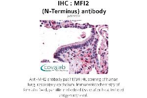 Image no. 2 for anti-Antigen P97 (Melanoma Associated) Identified By Monoclonal Antibodies 133.2 and 96.5 (MFI2) (N-Term) antibody (ABIN1736928) (MFI2 Antikörper  (N-Term))