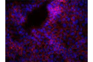 Immunofluorescence (IF) image for anti-Epithelial Cell Adhesion Molecule (EPCAM) antibody (Alexa Fluor 647) (ABIN2657756) (EpCAM Antikörper  (Alexa Fluor 647))