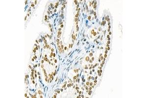 Immunohistochemistry analysis of paraffin-embedded rat ovary using,Mettl11a (ABIN7074612) at dilution of 1: 1500
