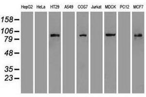 Image no. 1 for anti-Catenin (Cadherin-Associated Protein), beta 1, 88kDa (CTNNB1) (AA 531-781) antibody (ABIN1496902) (CTNNB1 Antikörper  (AA 531-781))