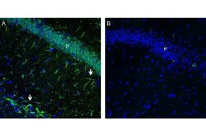 Expression of GPR43/FFAR2 in mouse hippocampus. (FFAR2 Antikörper  (C-Term, Intracellular))