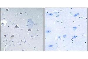 Immunohistochemistry analysis of paraffin-embedded human brain tissue, using p70 S6 Kinase (Ab-371) Antibody. (RPS6KB1 Antikörper  (AA 337-386))