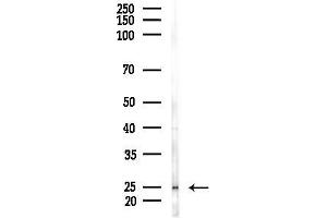 anti-Transmembrane BAX Inhibitor Motif Containing 6 (TMBIM6) antibody