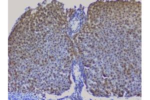 IHC analysis of NRF1 using anti-NRF1 antibody (ABIN6719347). (NRF1 Antikörper  (AA 246-503))