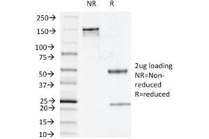 SDS-PAGE Analysis Purified Thymidine Phosphorylase / PD-ECGF Mouse Monoclonal Antibody (P-GF. (Thymidine Phosphorylase Antikörper)