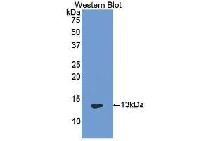 Western Blotting (WB) image for anti-Keratin 1 (KRT1) (AA 489-625) antibody (ABIN1859571) (Cytokeratin 1 Antikörper  (AA 489-625))