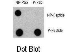 Dot blot analysis of Phospho-LC3 (APG8a) - Ser12 Antibody and Non phospho-LC3 (APG8a) Antibody on nitrocellulose membrane.