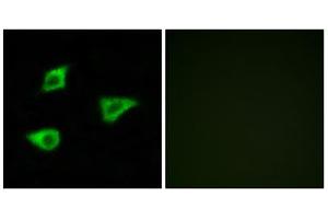 Immunofluorescence analysis of LOVO cells, using CHRM4 antibody.