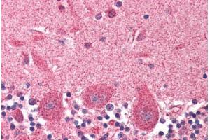 Human Brain, Cerebellum (formalin-fixed, paraffin-embedded) stained with DCTN1 antibody ABIN337005 at 2. (Dynactin 1 Antikörper  (AA 1266-1278))