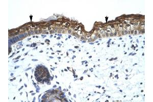 SMARCA2 antibody was used for immunohistochemistry at a concentration of 4-8 ug/ml to stain Squamous epithelial cells (arrows) in Human Skin. (SMARCA2 Antikörper  (Middle Region))