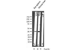 Western blot analysis of EFNB2 expression in various lysates (Ephrin B2 Antikörper  (C-Term))
