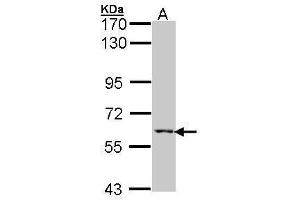 Western Blotting (WB) image for anti-Methylcrotonoyl-CoA Carboxylase 2 (Beta) (MCCC2) (Center) antibody (ABIN2855455)