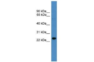 WB Suggested Anti-RAB9B Antibody Titration: 0. (RAB9B Antikörper  (N-Term))