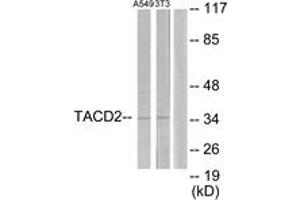 Western blot analysis of extracts from A549/NIH-3T3 cells, using TACD2 Antibody. (TACSTD2 Antikörper  (AA 131-180))