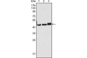 Western blot analysis using CK17 mouse mAb against Hela (1), MCF-7 (2) and A431 (3) cell lysate. (KRT17 Antikörper)